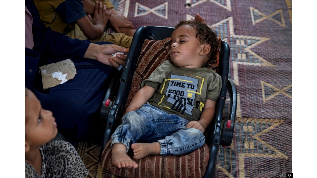 Displaced infant Abdel-Rahman Abu El-Jedian, who suffers from polio, sleeps at a makeshift tent camp in Deir al-Balah, central Gaza Strip, on Aug. 27, 2024.