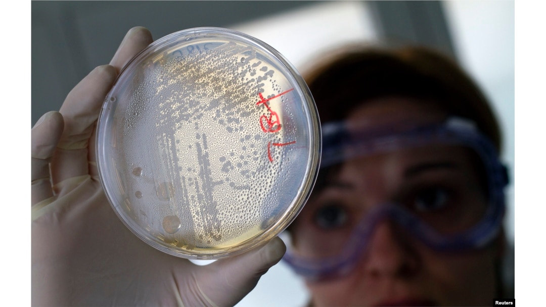 FILE - A laboratory worker looks for strains of E.coli bacteria in vegetable cells placed in a petri dish.