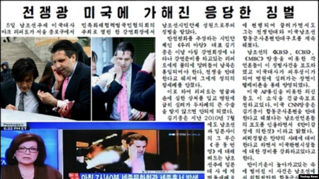 북한 노동당 기관지 노동신문이 지난 6일 5면에서 마크 리퍼트 주한 미국 대사 피습 소식을 보도하며 관련 사진 3장을 게재했다. 노동신문은 이들 사진과 함께 5일 나온 조선중앙통신 기사를 그대로 게재했다. (자료사진)